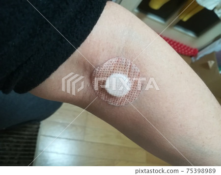 獻血後第二天刺傷針頭後貼上手臂和貼紙。 75398989