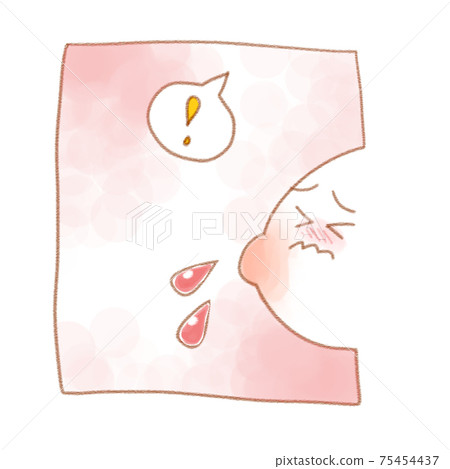 Breast milk mixed with blood (blood milk) Breast milk mixed with blood (blood milk) 75454437