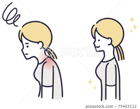 Kyphosis female simple illustration - Stock Illustration [75483112] - PIXTA