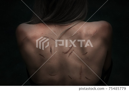 Close up of female back with a many scars on it 75485779