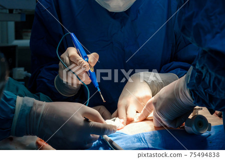 The surgeon holds the electrical coagulator during the operation. The surgeon holds the electrical coagulator during the operation. 75494838