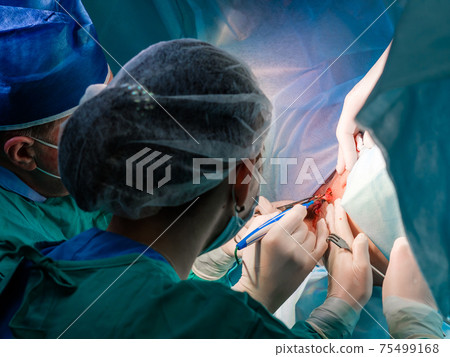 The surgeon holds the electrical coagulator during the operation. The surgeon holds the electrical coagulator during the operation. 75499168