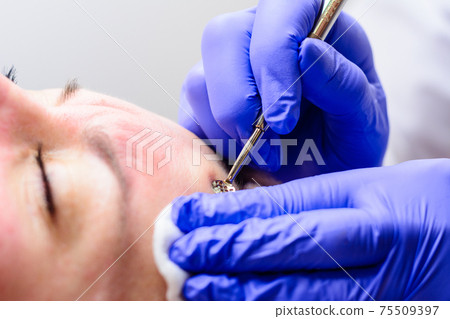 Mechanical facial cleansing, skin cleansing procedure from surface and deep impurities. Mechanical facial cleansing, skin cleansing procedure from surface and deep impurities. 75509397