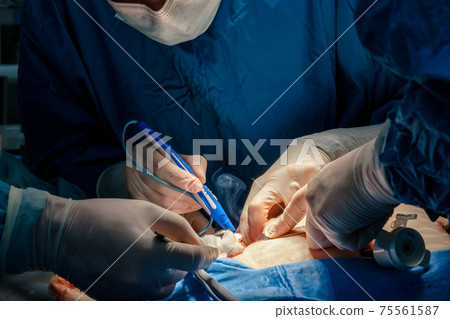 The surgeon holds the electrical coagulator during the operation. 75561587