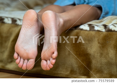 Closeup of woman feet sole with dry cracked skin. Foot and toes care concept. 75579589