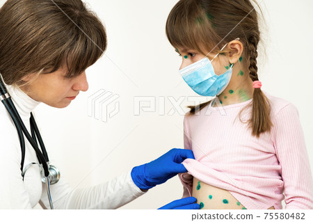 Doctor examining child girl covered with green rashes on face and stomach ill with chickenpox, measles or rubella virus. 75580482