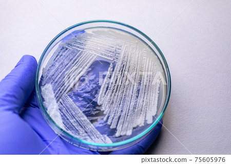 Pichia is a genus of yeasts in the family Saccharomycetaceae under the microscope for education. 75605976