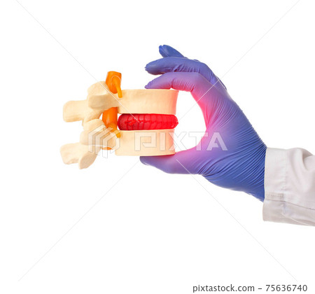 Doctor holds a segment of the human spine in his hand on a white background, isolate. The concept of the treatment of intervertebral hernia and osteochondrosis Doctor holds a segment of the human spine in his hand on a white background, isolate. The concept of the treatment of intervertebral hernia and osteochondrosis 75636740