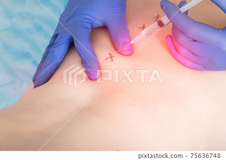 The doctor gives the patient's girl a medical injection of a blockade into the nerve plexuses of the sacro-lumbar region. Back pain treatment and pain relief concept. Copy space for text 75636748