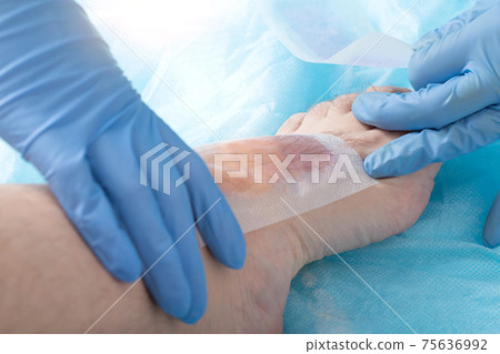 The doctor removes hair from toes with epilating wax strips. Hygiene and cosmetology concept, close-up 75636992