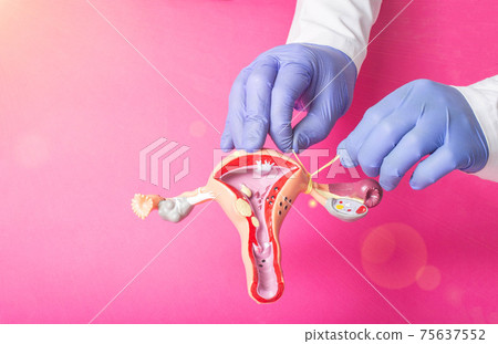 Doctor gynecologist ligates the fallopian tubes on the example of the layout of the female reproductive system, pink background. Contraception concept for unwanted pregnancy, copy space for text Doctor gynecologist ligates the fallopian tubes on the example of the layout of the female reproductive system, pink background. Contraception concept for unwanted pregnancy, copy space for text 75637552