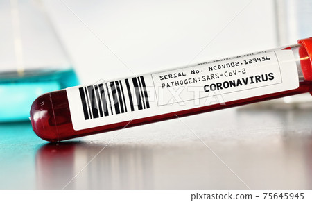 Coronavirus test concept - vial with blood above desk, closeup detail (label is own design, data and barcode are dummy) blurred laboratory glass background Coronavirus test concept - vial with blood above desk, closeup detail (label is own design, data and barcode are dummy) blurred laboratory glass background 75645945