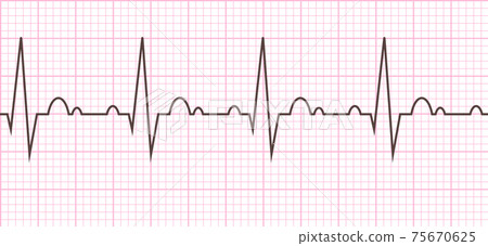 Heart beat. Cardiogram. Cardiac cycle Heart beat. Cardiogram. Cardiac cycle 75670625