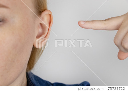 Darwin's tubercle on the ear. The girl at the reception at the plastic surgeon, shows the auricle. Darwin's tubercle on the ear. The girl at the reception at the plastic surgeon, shows the auricle. 75723722