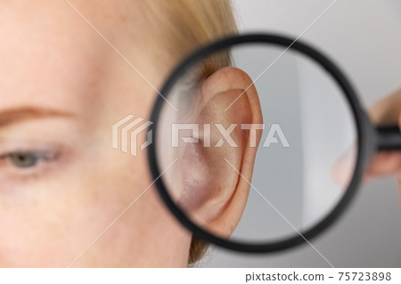 Darwin's tubercle on the ear. The girl at the reception at the plastic surgeon, shows the auricle. Darwin's tubercle on the ear. The girl at the reception at the plastic surgeon, shows the auricle. 75723898