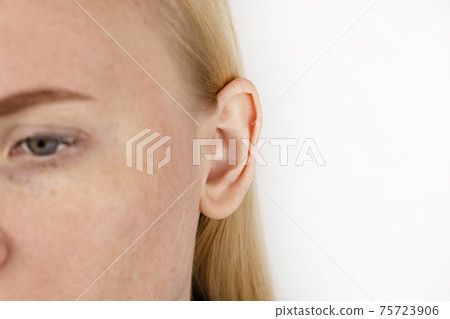 Darwin's tubercle on the ear. The girl at the reception at the plastic surgeon, shows the auricle. Darwin's tubercle on the ear. The girl at the reception at the plastic surgeon, shows the auricle. 75723906
