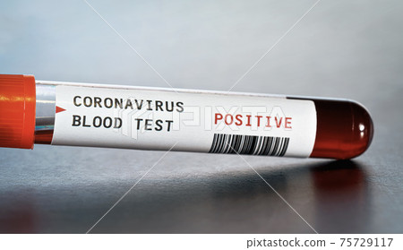 Sample vial with blood, label says coronavirus test, positive result.  (sticker is own design, dummy barcode). Covid-19 outbreak concept 75729117