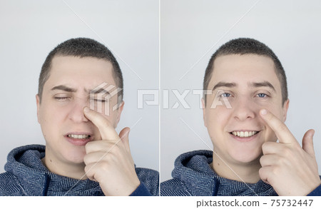 Before and after. On the left, the man indicates nose pain, and on the right, indicates that nose no longer hurts. Professional medical care assistance concept. Treatment of allergies and nosebleeds Before and after. On the left, the man indicates nose pain, and on the right, indicates that nose no longer hurts. Professional medical care assistance concept. Treatment of allergies and nosebleeds 75732447