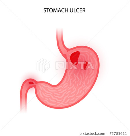 Stomach logo concept 75785611