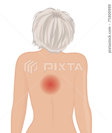 Back pain female body vector illustration on a white background 75800999