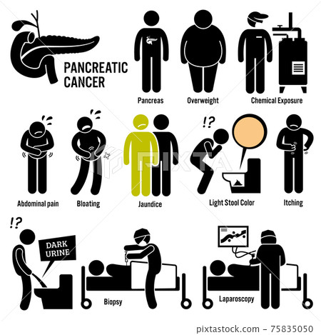 Pancreatic Pancreas Cancer Symptoms Causes Risk Factors Diagnosis Stick Figure Pictogram Icons.  75835050