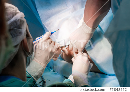 The surgeon holds the electrical coagulator during the operation. The surgeon holds the electrical coagulator during the operation. 75848352