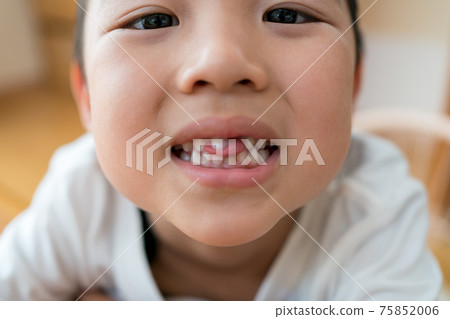 Regeneration of milk teeth Regeneration of milk teeth 75852006