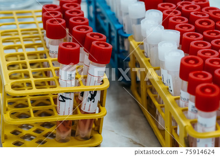 Test tubes with close-up pcr results in laboratory 75914624