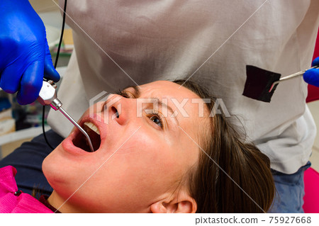 The dentist washes the tooth treatment site with water, washes away the blood and tooth debris. 75927668