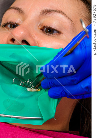 The dentist treats the patient's tooth with a rubber dam, drill, mirror. The dentist treats the patient's tooth with a rubber dam, drill, mirror. 75927679