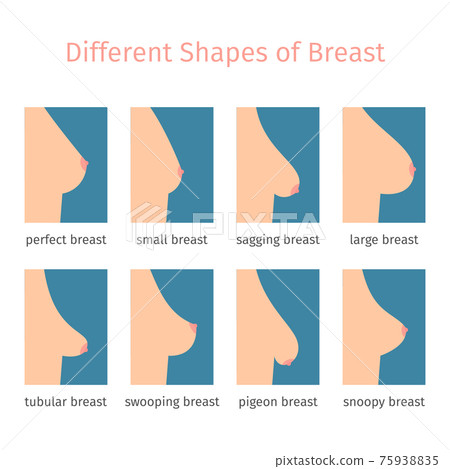 Breast Shape Chart Breast Shape Chart
