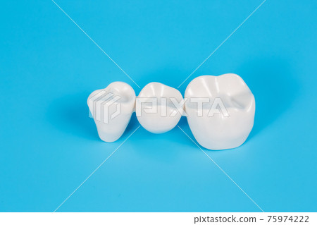 Dental crowns, imitation of a dental prosthesis of a dental bridge Dental crowns, imitation of a dental prosthesis of a dental bridge 75974222