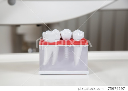Plastic dental crowns, imitation of a dental prosthesis of a dental bridge Plastic dental crowns, imitation of a dental prosthesis of a dental bridge 75974297