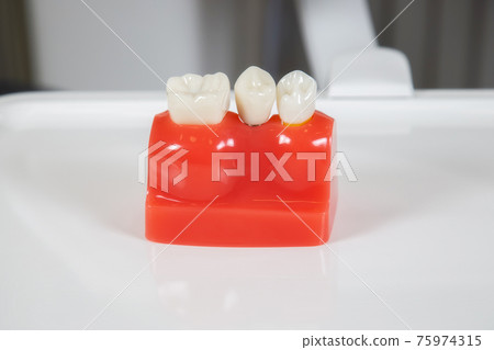Plastic dental crowns, imitation of a dental prosthesis of a dental bridge 75974315