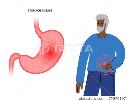 Stomach disease concept 75976197