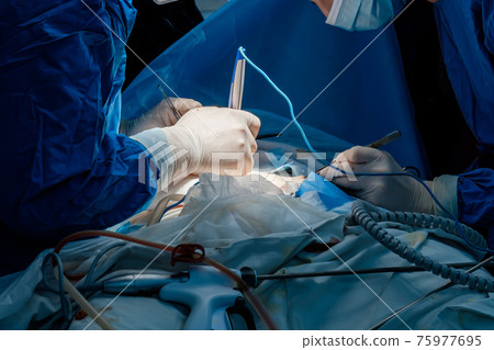 The surgeon makes incisions in the skin with an electrocoagulator. The surgeon makes incisions in the skin with an electrocoagulator. 75977695