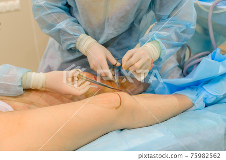 Surgeons suture their knees after liposuction. Close-up of plastic surgery to remove excess fat. 75982562