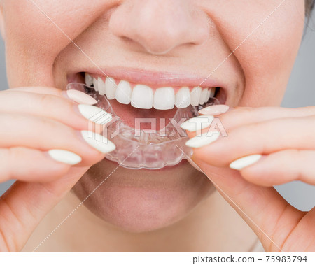 Close-up portrait of a woman putting on a transparent plastic retainer. A girl corrects a bite with the help of an orthodontic device 75983794