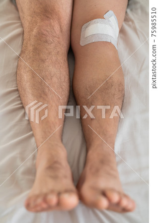 Close-up of male legs with knee taped with tape after laparoscopic minisk surgery 75985510