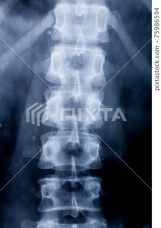 x-ray image 75986594