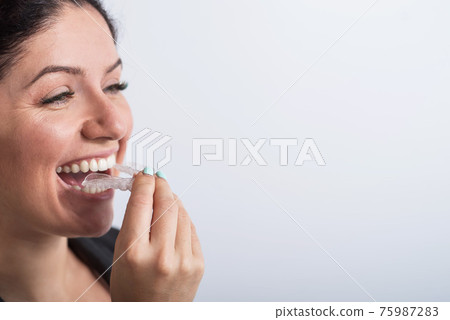 A woman uses transparent retainers to whiten teeth 75987283