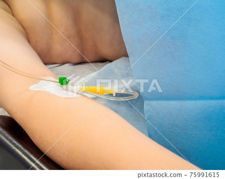 Intravenous drip during surgery in the patient's hand. Intravenous drip during surgery in the patient's hand. 75991615