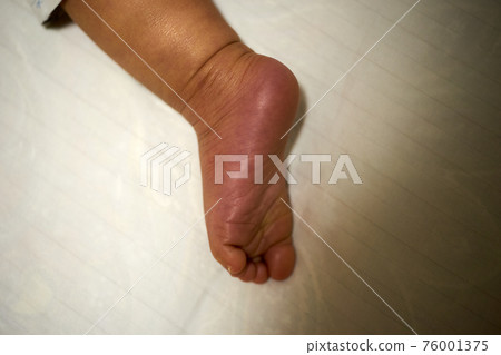 Baby's foot, left foot, up 76001375