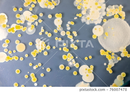 Mold Beautiful, Colony of Characteristics of Fungus (Mold) in culture medium plate from laboratory microbiology. 76007478
