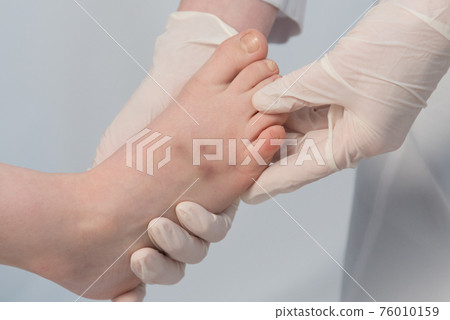 The doctor gently feels the child s foot. Bruises are visible on the patient s leg. Appointment with a doctor. Surgeon, traumatologist or orthopedist. Palpation. Bruise or fracture 76010159
