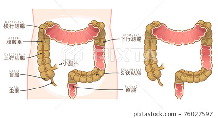 Cross-section illustration of the large intestine Cross-section illustration of the large intestine 76027597