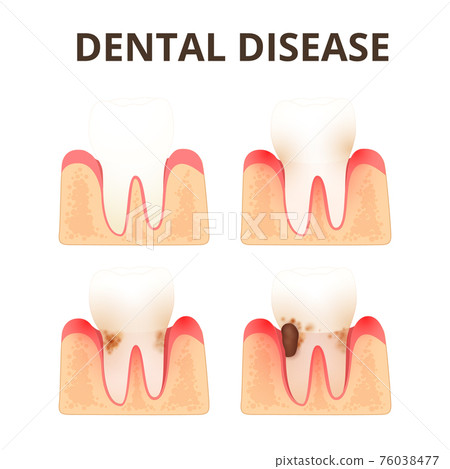 structure of human teeth structure of human teeth 76038477