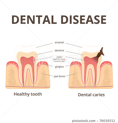 structure of human teeth 76038552