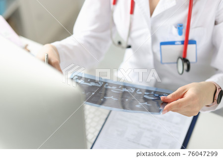 Doctor holds an X-ray picture of patient in his hands 76047299