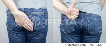 Before and after pain in ass. Conceptual shot of anal problems. On left, the man grabbed his butt in pain, and on the right, everything had already passed. Treatment of hemorrhoids and rectal fissures Before and after pain in ass. Conceptual shot of anal problems. On left, the man grabbed his butt in pain, and on the right, everything had already passed. Treatment of hemorrhoids and rectal fissures 76086665